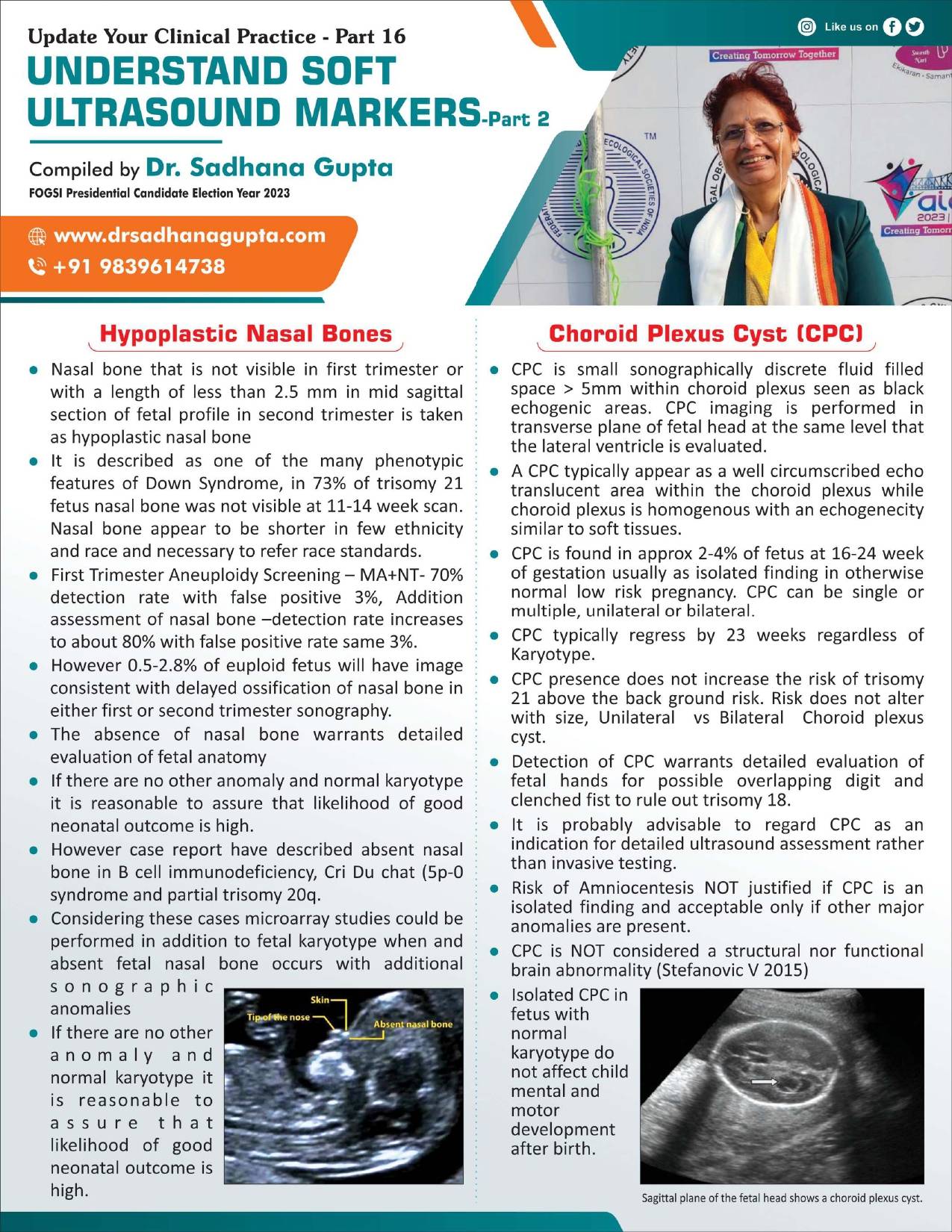 Understand Soft ultrasound Markers (Part 2)