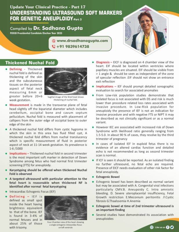 Understanding Ultrasound Soft Markers For Genetic Aneuploidy (Part 3)