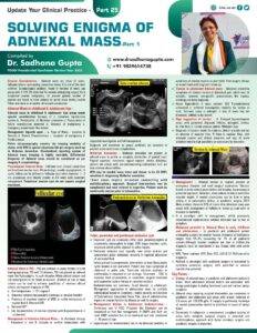 Solving Enigma of Adnexal Mass – Part 1