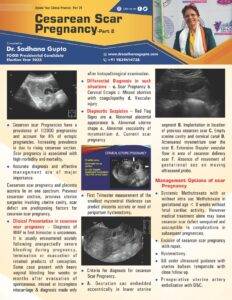 Cesarean Scar Pregnancy _Part 2