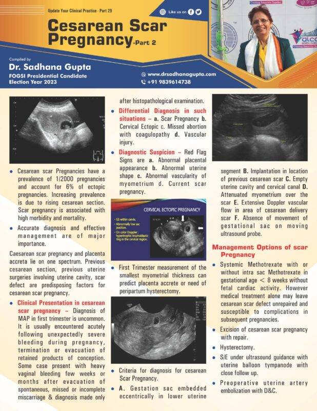 Cesarean Scar Pregnancy _Part 2