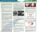 Endometriosis (Part-1)
